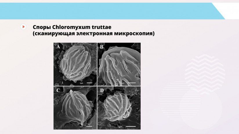 Владимир Воронин. Паразитарные болезни форели и сиговых. Миксоспоридии и миксоспоридиозы