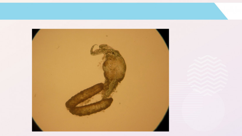 Владимир Воронин. Паразитарные болезни форели и сиговых. Крустацеозы. Нематоды. Пиявки